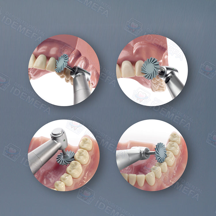 Shapeguard Pulidor para Resina