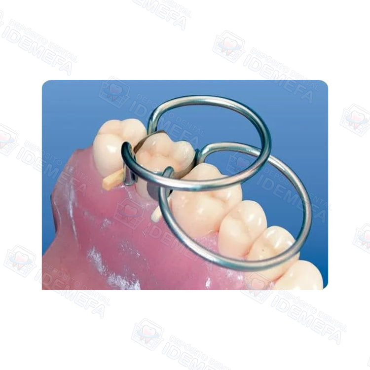 Contact Matrix Dental Ring, Matrices dentales para restauraciones precisas de clase II