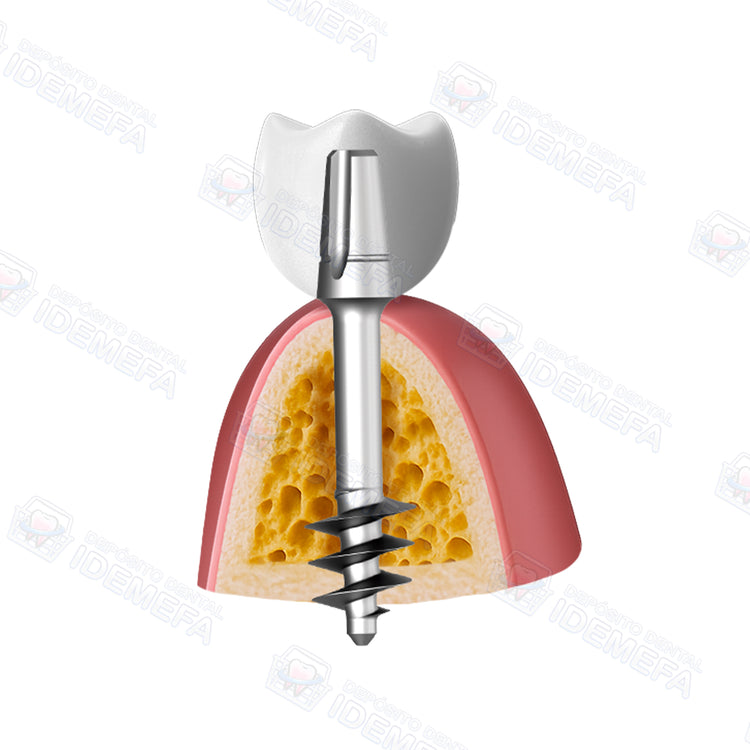 Implante Basal BCS® by IHDE Dental®