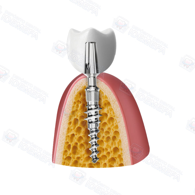 Sistemas de Implantes TPG® y TPG® uno by IHDE Dental®