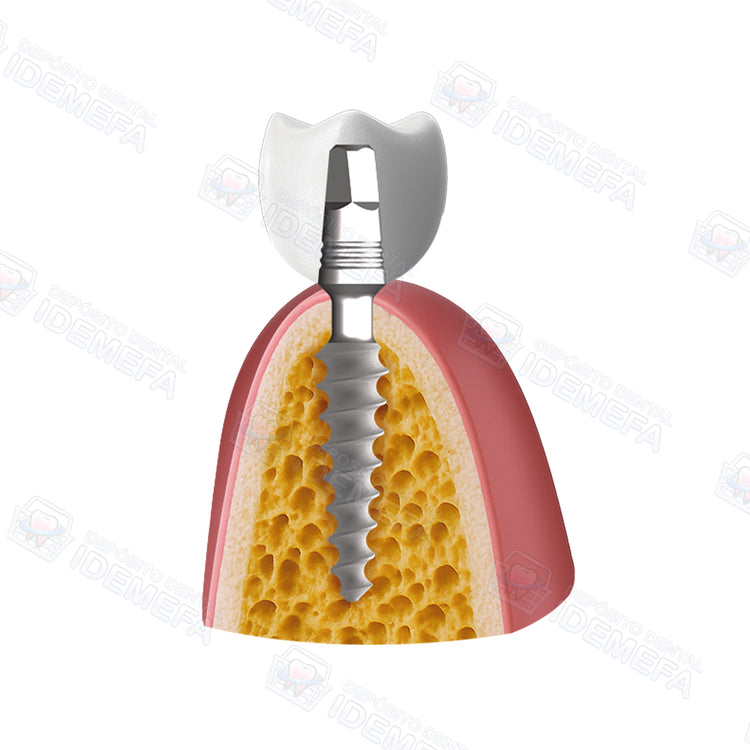 Implante KOS Classic® Recto (Pilar Pequeño) by IHDE Dental®