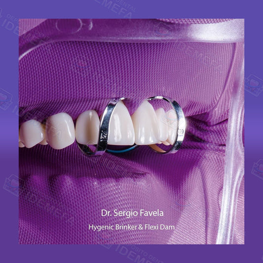 Flexi Dam: Dique Sin Latex Morado