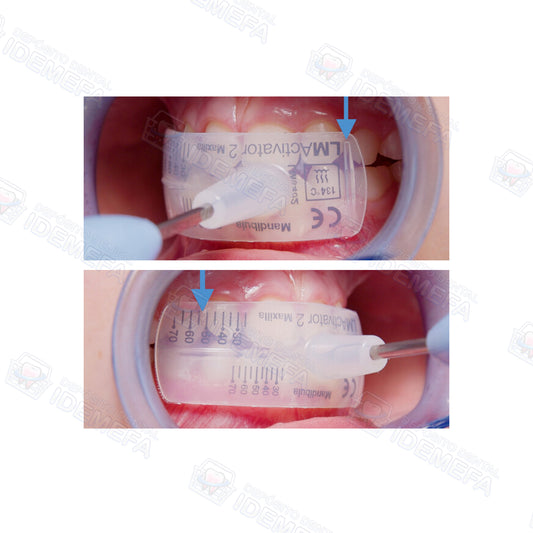 OrthoSizer™ - Herramienta de Medición by LM-Dental™