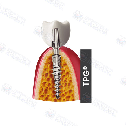 Sistemas de Implantes TPG® y TPG® uno by IHDE Dental®