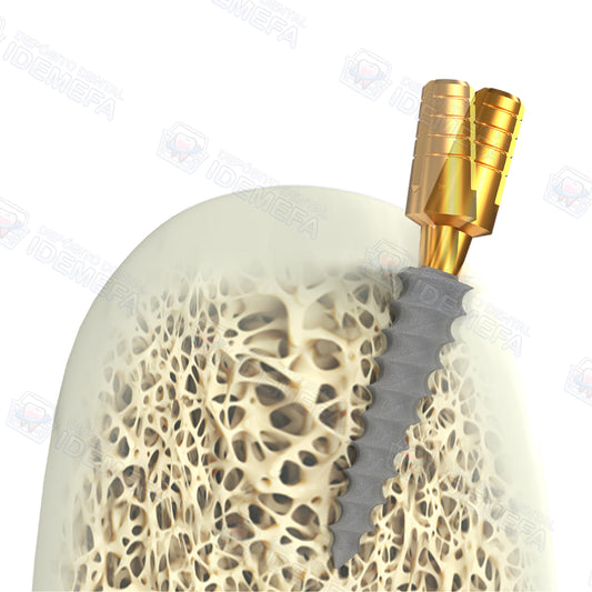 Implante Monofásico Compresivo de Cuello Doblable (Compressive Bendable) - BioLine®