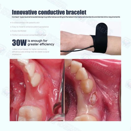 Unidad de Electrocirugía/ Electrobisturí