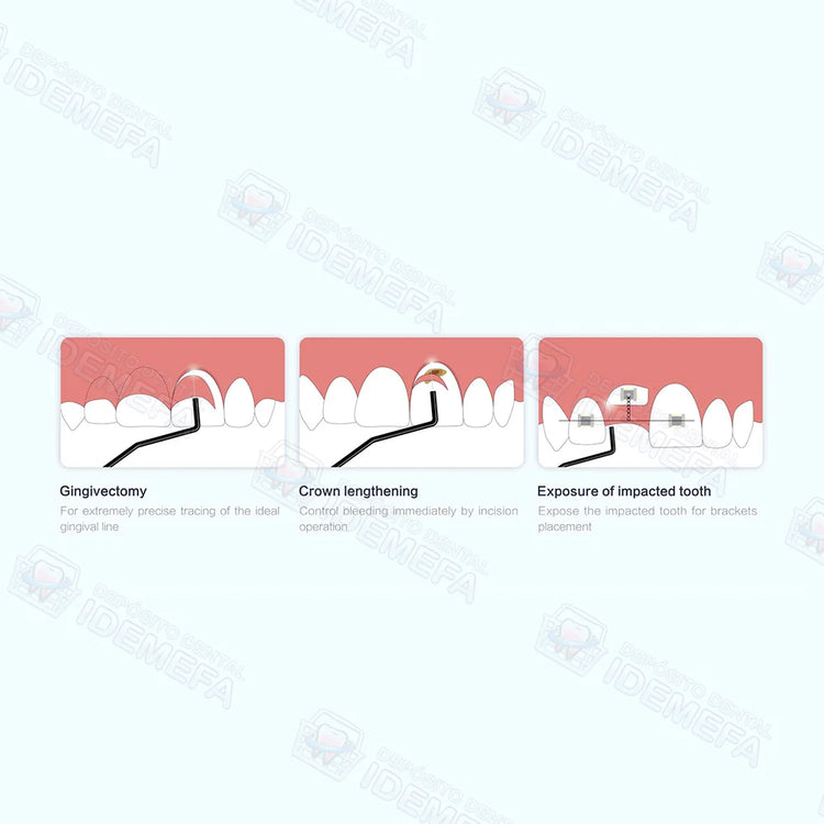 Unidad de Electrocirugía/ Electrobisturí