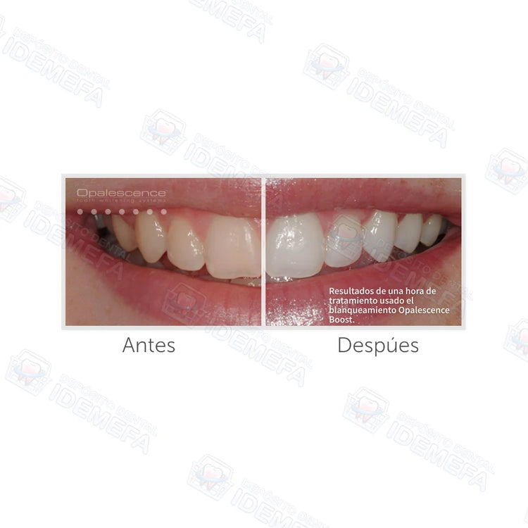 Opalescence Boost
