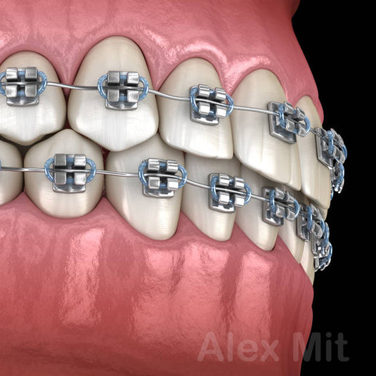 Ortodoncia / Ortodônticos