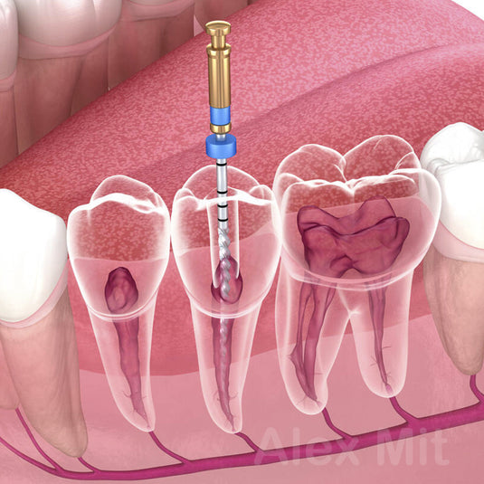 Endodoncia / Endodônticos