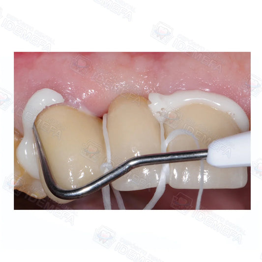 GC Fuji PLUS® - Polvo (Tono Yellow / Amarillo) 15g