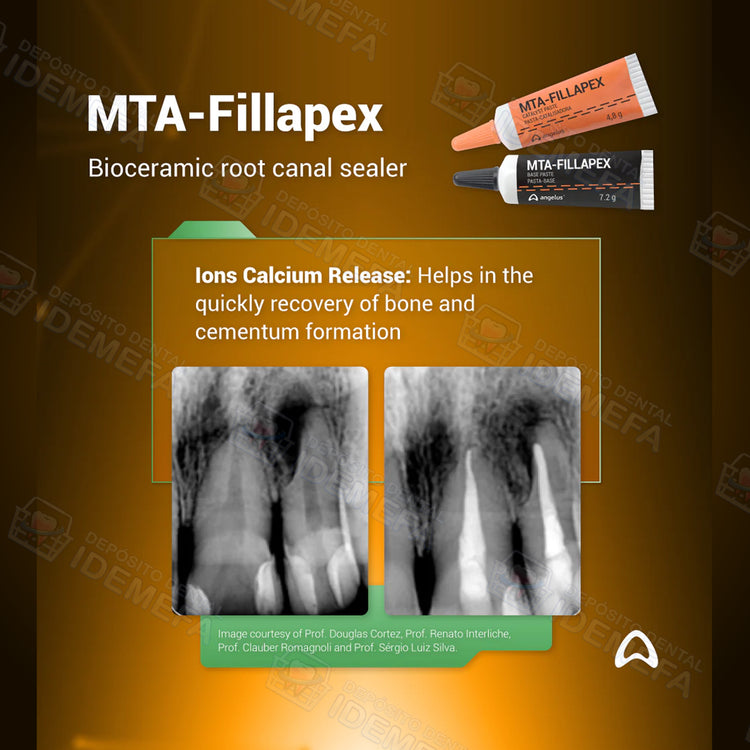 MTA-Fillapex Angelus®