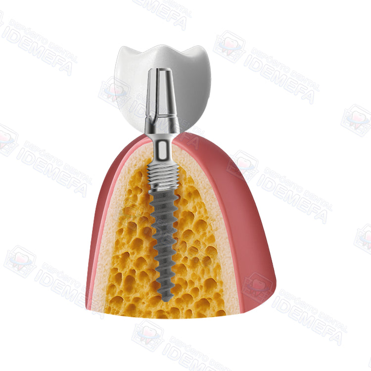 Implante KOS Micro® (Pilar Grande) by IHDE Dental®