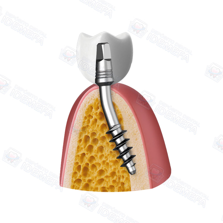 Implante Basal BCS® by IHDE Dental®