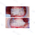 OrthoSizer™ - Herramienta de Medición by LM-Dental™