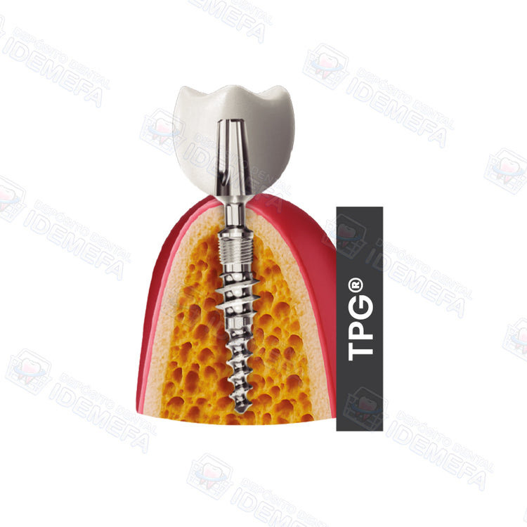 Sistemas de Implantes TPG® y TPG® uno by IHDE Dental®
