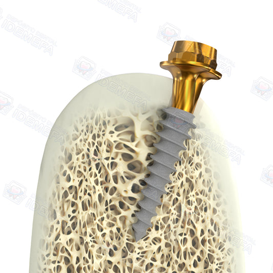 Implante Monofásico Compresivo Multi-Unit (Compressive Multi Unit) - BioLine®