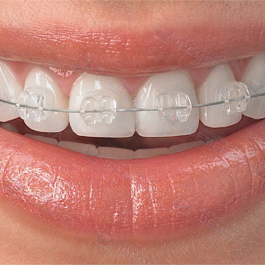 Arcos Ni-Ti Estéticos Recubiertos – Discreción y Rendimiento